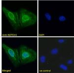 NOTCH1 Antibody in Immunocytochemistry (ICC/IF)