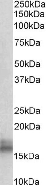 NPC2 Antibody in Western Blot (WB)