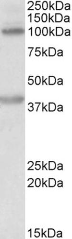 ZEB2 Antibody in Western Blot (WB)