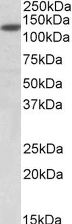 SIRT1 Antibody in Western Blot (WB)