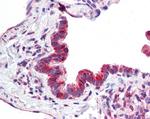 MICU1 Antibody in Immunohistochemistry (Paraffin) (IHC (P))