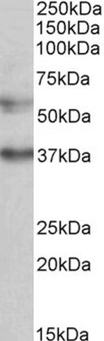 MICU1 Antibody in Western Blot (WB)