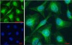 PTCH Antibody in Immunocytochemistry (ICC/IF)