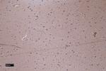 PTCH Antibody in Immunohistochemistry (Paraffin) (IHC (P))