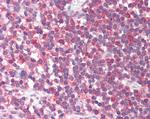 MTHFD1L Antibody in Immunohistochemistry (Paraffin) (IHC (P))