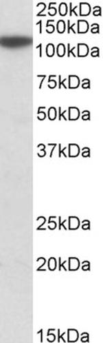 MTHFD1L Antibody in Western Blot (WB)