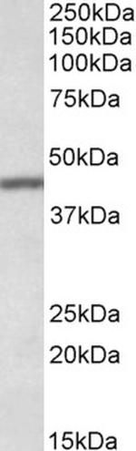 TFB2M Antibody in Western Blot (WB)