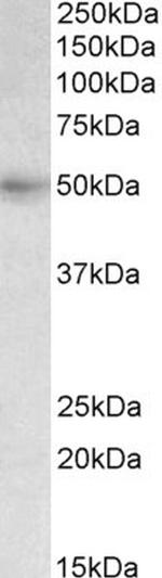 SLC46A1 Antibody in Western Blot (WB)