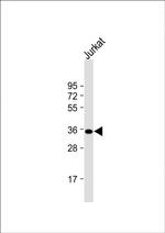 FBP1 Antibody in Western Blot (WB)