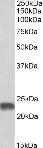 SOD2 (MnSOD) Antibody in Western Blot (WB)