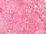 SOD2 (MnSOD) Antibody in Immunohistochemistry (Paraffin) (IHC (P))