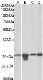 SOD2 (MnSOD) Antibody in Western Blot (WB)