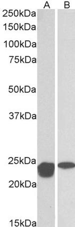 SOD2 (MnSOD) Antibody in Western Blot (WB)