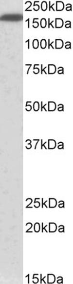 Neurofascin Antibody in Western Blot (WB)