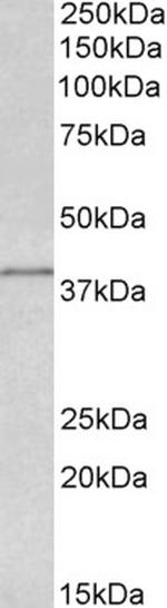 IDH3G Antibody in Western Blot (WB)