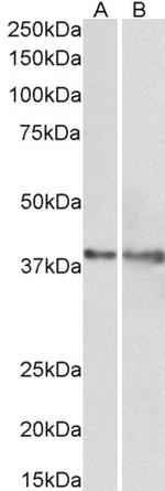 IDH3G Antibody in Western Blot (WB)