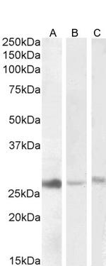 DNAJB9 Antibody in Western Blot (WB)