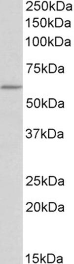 TPH2 Antibody in Western Blot (WB)