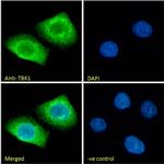 TBK1 Antibody in Immunocytochemistry (ICC/IF)