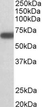 GAD67 Antibody in Western Blot (WB)