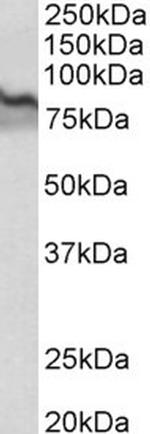 TGM2 Antibody in Western Blot (WB)