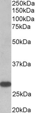 TSH Receptor Antibody in Western Blot (WB)