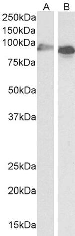 CYP1A1 Antibody in Western Blot (WB)