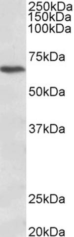 CACNB2 Antibody in Western Blot (WB)