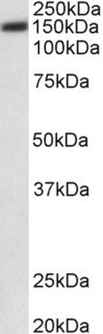 PMCA1 ATPase Antibody in Western Blot (WB)