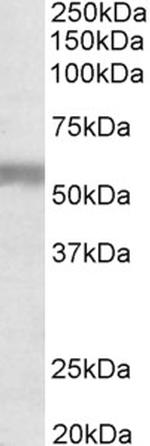 NPR3 Antibody in Western Blot (WB)