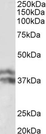 Haptoglobin beta Antibody in Western Blot (WB)