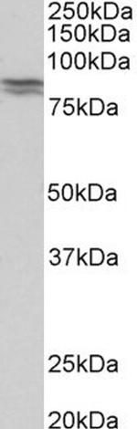 E-cadherin Antibody in Western Blot (WB)