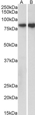 E-cadherin Antibody in Western Blot (WB)