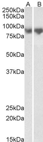 E-cadherin Antibody in Western Blot (WB)