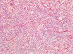 Vimentin Antibody in Immunohistochemistry (Paraffin) (IHC (P))