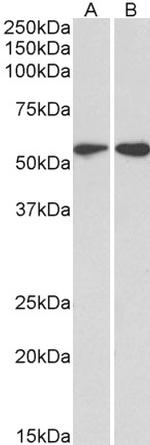 Vimentin Antibody in Western Blot (WB)