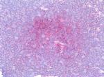 IRF4 Antibody in Immunohistochemistry (Paraffin) (IHC (P))