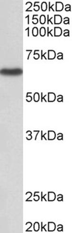 MST2 Antibody in Western Blot (WB)