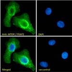 mTOR Antibody in Immunocytochemistry (ICC/IF)