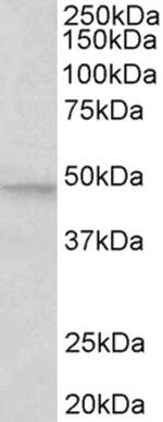 JNK2 beta Antibody in Western Blot (WB)