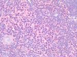 STAT5 alpha Antibody in Immunohistochemistry (Paraffin) (IHC (P))