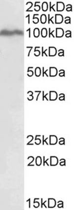 STAT5 alpha Antibody in Western Blot (WB)