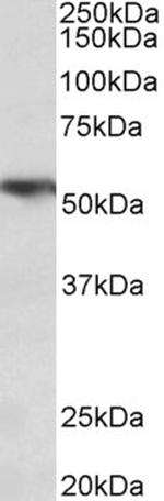 TNFR1 Antibody in Western Blot (WB)