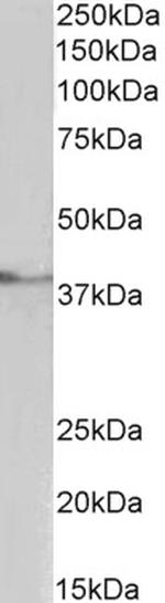 TBP Antibody in Western Blot (WB)