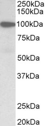 Gelsolin Antibody in Western Blot (WB)