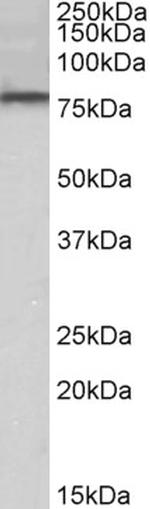 DYRK1A Antibody in Western Blot (WB)