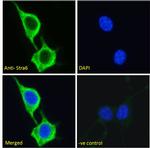 STRA6 Antibody in Immunocytochemistry (ICC/IF)