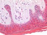 S100A8 Antibody in Immunohistochemistry (Paraffin) (IHC (P))