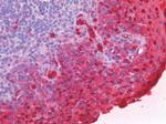 S100A8 Antibody in Immunohistochemistry (Paraffin) (IHC (P))