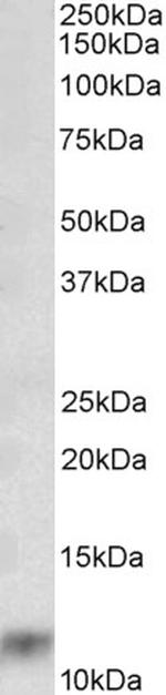 S100A8 Antibody in Western Blot (WB)